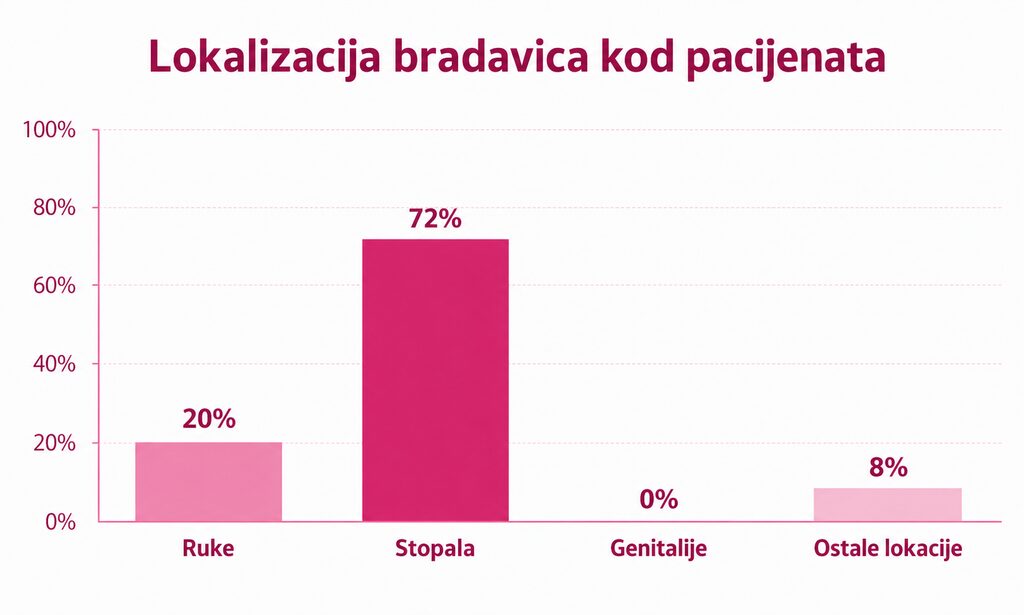Lokalizacija bradavica po tijelu Lokalizacija bradavica po tijelu